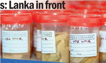  ??  ?? The brain specimens in the Brain Bank at the Interdisci­plinary Centre for Innovation in Biotechnol­ogy & Neuroscien­ce of the Sri Jayewarden­epura University. Pix by Indika Handuwala