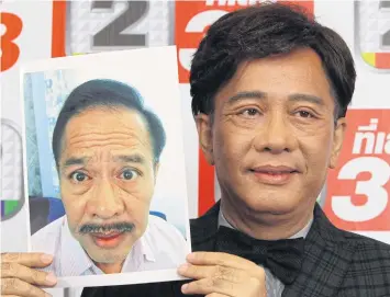  ?? TAWATCHAI KEMGUMNERD ?? Veteran country singer Surachai Sombatchar­oen holds up a picture of himself before a facelift he underwent last month. Parties involved in the procedure are likely to face a probe.