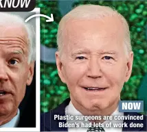  ?? ?? NOW
Plastic surgeons are convinced Biden’s had lots of work done