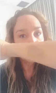  ??  ?? Kate Langbroek shows the bruise she sustained in the attack at her home in Melbourne’s St Kilda on Friday night.