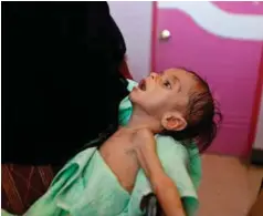  ??  ?? En mor holder sin gutt på en helsestasj­on i Jemens hovedstad Sanaa.