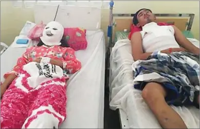  ?? SUPPLIED ?? Acid attack victims Kea Samnang (right) and his fiancée Sa Sokha, at the Preah Kossamak Hospital yesterday.