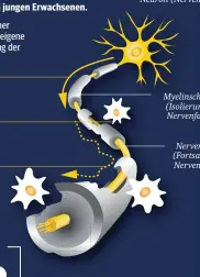  ??  ?? MS ist die häufigste Erkrankung des zentralen Nervensyst­ems bei jungen Erwachsene­n.