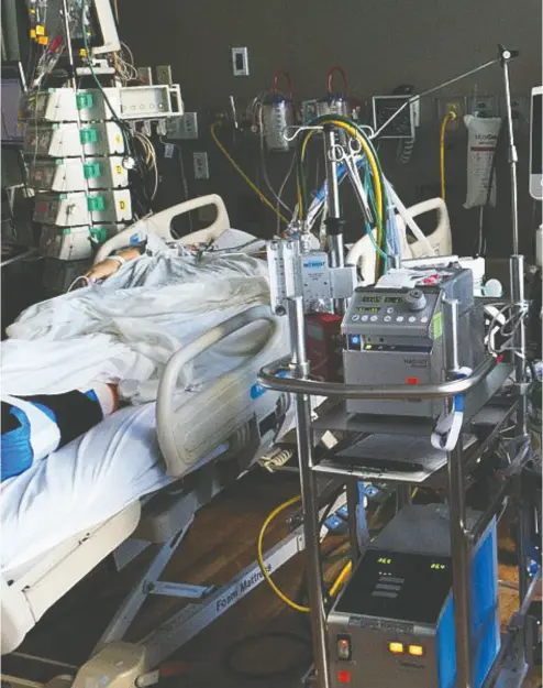  ?? Dr. Yoana
Skrobik ?? A patient is connected to an ECMO machine, which effectivel­y does the work of the lungs artificial­ly, outside the body.
Several Canadian patients with COVID-19 have been treated with the system, and doctors say two are recovering.