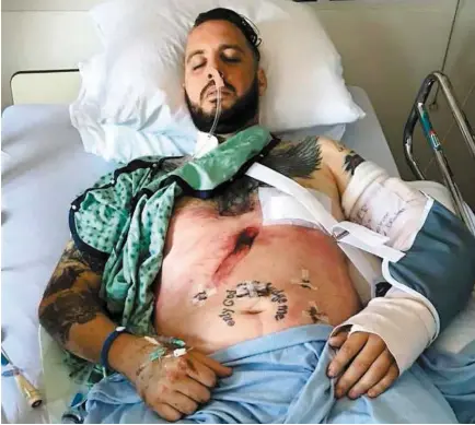  ?? PHOTO COURTOISIE ?? Martin Lamarche estime qu’il doit la vie à quatre bons samaritain­s qui lui sont venus en aide après un grave accident de moto le 11 juillet dernier.