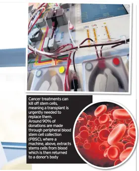  ??  ?? Cancer treatments can kill off stem cells, meaning a transplant is urgently needed to replace them. Around 90% of donations are made through peripheral blood stem cell collection (PBSC), where a machine, above, extracts stems cells from blood which is then returned to a donor’s body